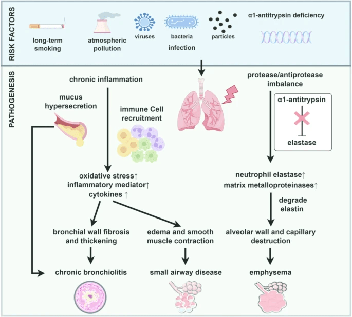 圖1：慢性阻塞性肺疾病的風(fēng)險因素和發(fā)病機(jī)制。