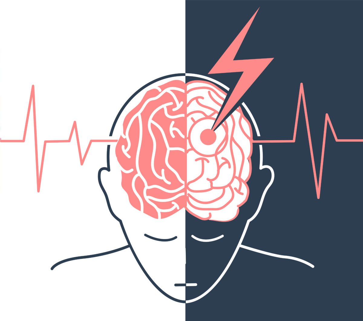 宣武醫院發布：間充質干細胞治療中風，可以改善患者神經功能障礙