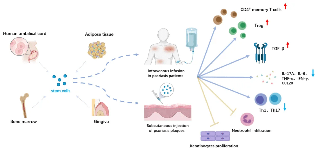 圖3:干細胞在銀屑病治療中的應用 圖3:干細胞在銀屑病治療中的應用