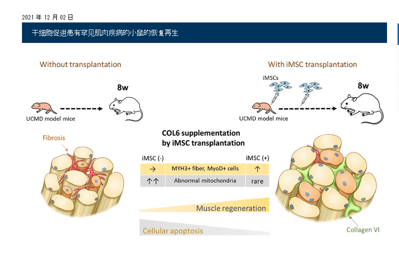2021年干細胞治療肌肉萎縮癥臨床案例