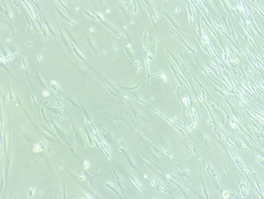 顯微鏡下的神經(jīng)干細胞。