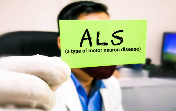 干細胞療法治療漸凍癥:間充質(zhì)干細胞、神經(jīng)干細胞和誘導性多能干細胞的療效比較 干細胞療法治療漸凍癥:間充質(zhì)干細胞、神經(jīng)干細胞和誘導性多能干細胞的療效比較