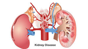 減輕負(fù)擔(dān),延長(zhǎng)生命:干細(xì)胞療法對(duì)降低腎病透析并發(fā)癥的影響評(píng)估