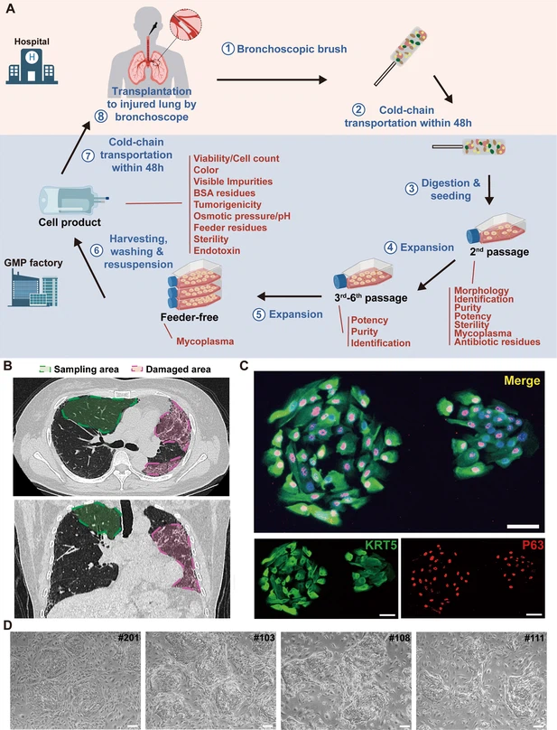 圖1：從IPF患者中分離的P63+肺祖細胞的克隆和表征。
