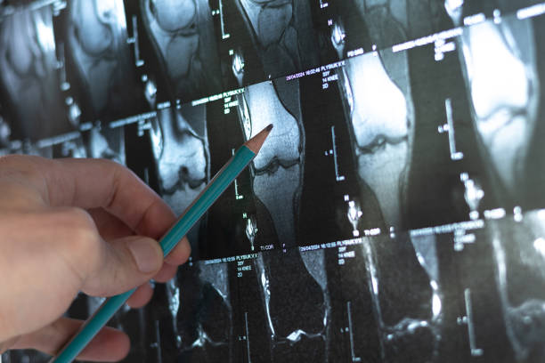 4種細胞療法運用免疫調(diào)節(jié)和再生機制為治療骨科疾病開辟了新方向