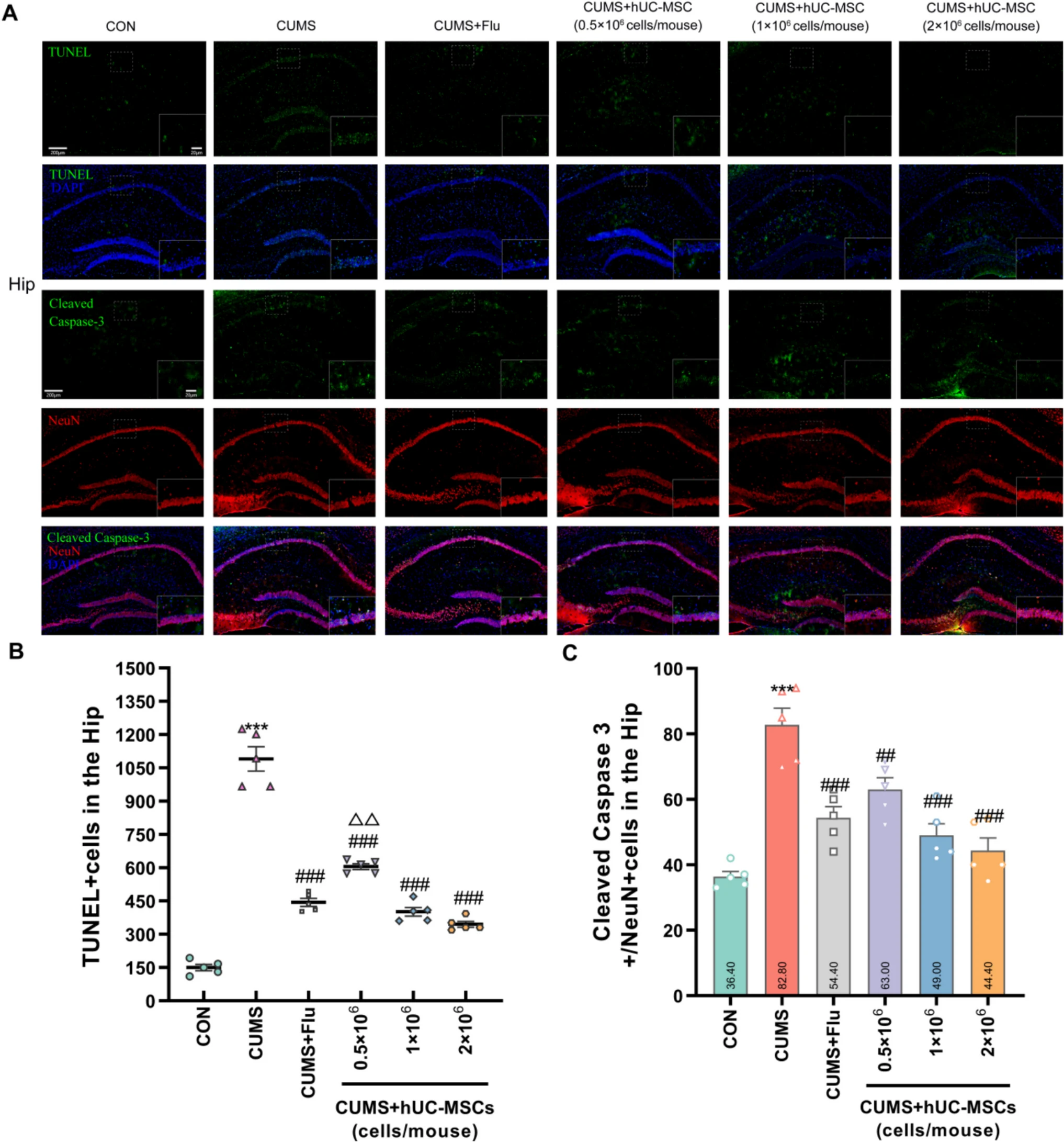 圖2:hUC-MSCs減輕了CUMS小鼠海馬 (Hip) 中的神經(jīng)元損傷 圖2:hUC-MSCs減輕了CUMS小鼠海馬 (Hip) 中的神經(jīng)元損傷