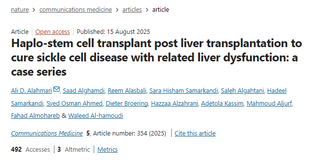 肝移植后單倍體干細胞移植治療鐮狀細胞病及相關肝功能障礙:病例系列 肝移植后單倍體干細胞移植治療鐮狀細胞病及相關肝功能障礙:病例系列