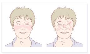 2025年1-12月干細胞治療系統性紅斑狼瘡匯總：多項臨床試驗全面提速！