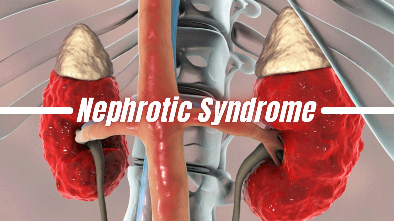 2022-2025年干細胞治療腎病綜合征最新臨床研究進展 2022-2025年干細胞治療腎病綜合征最新臨床研究進展