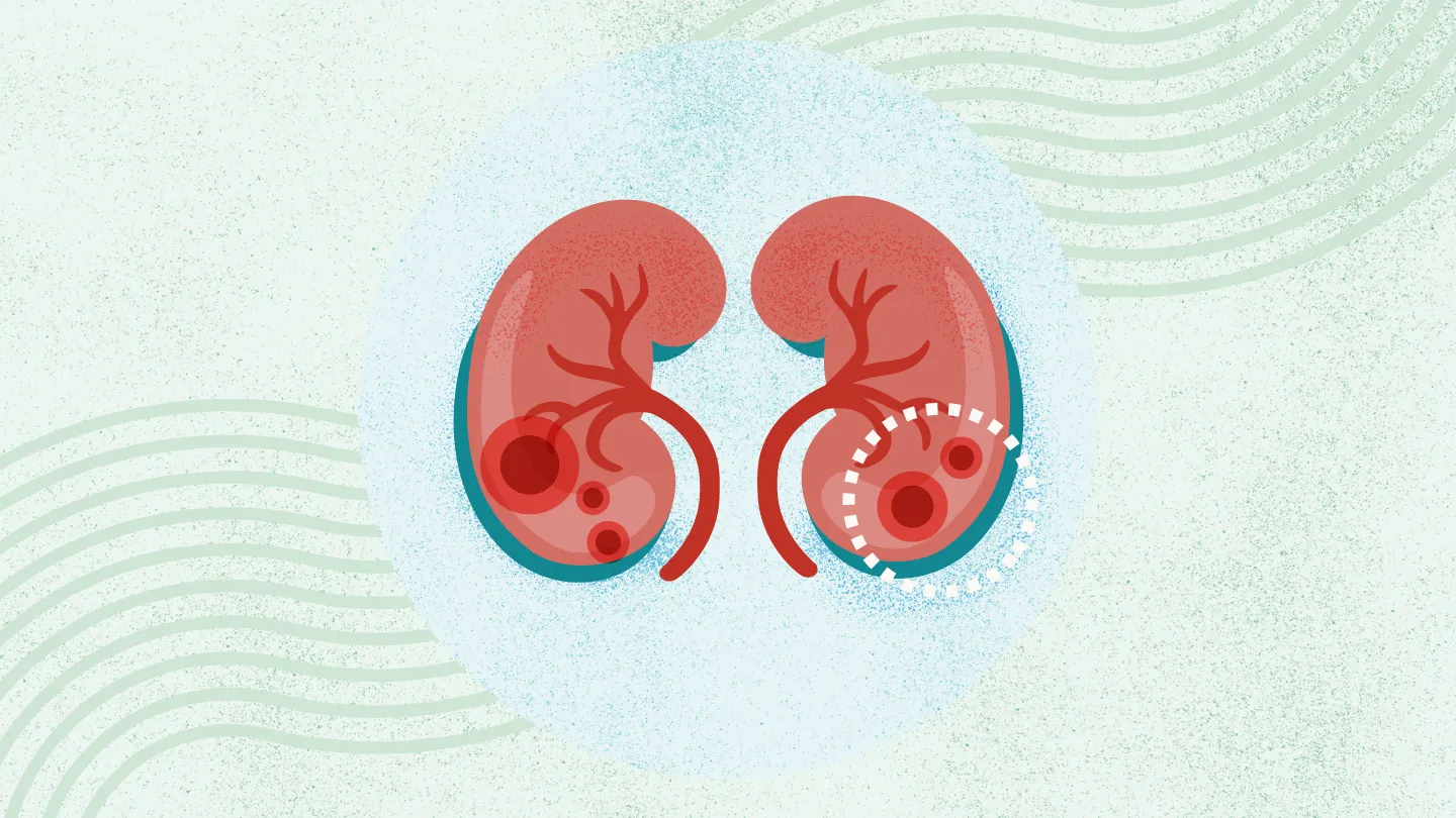 2025年國內(nèi)干細胞治療腎病的醫(yī)院都有哪幾家？