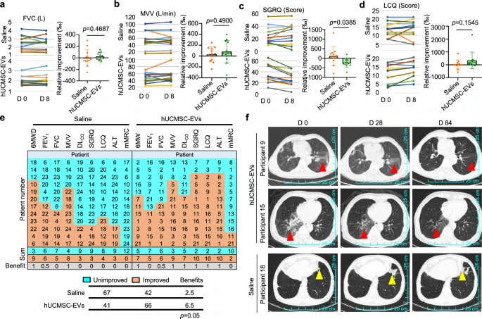 圖5：霧化吸入hUCMSC-EVs治療肺纖維化的臨床療效