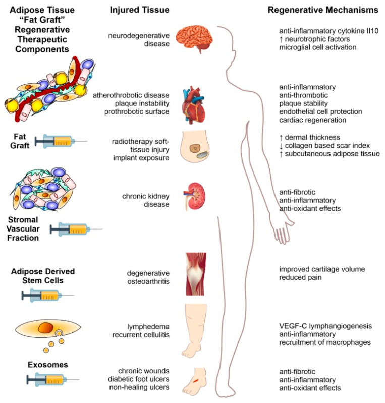 圖2：本文以示意圖形式概述了利用脂肪組織脂肪治療人類疾病的方法。