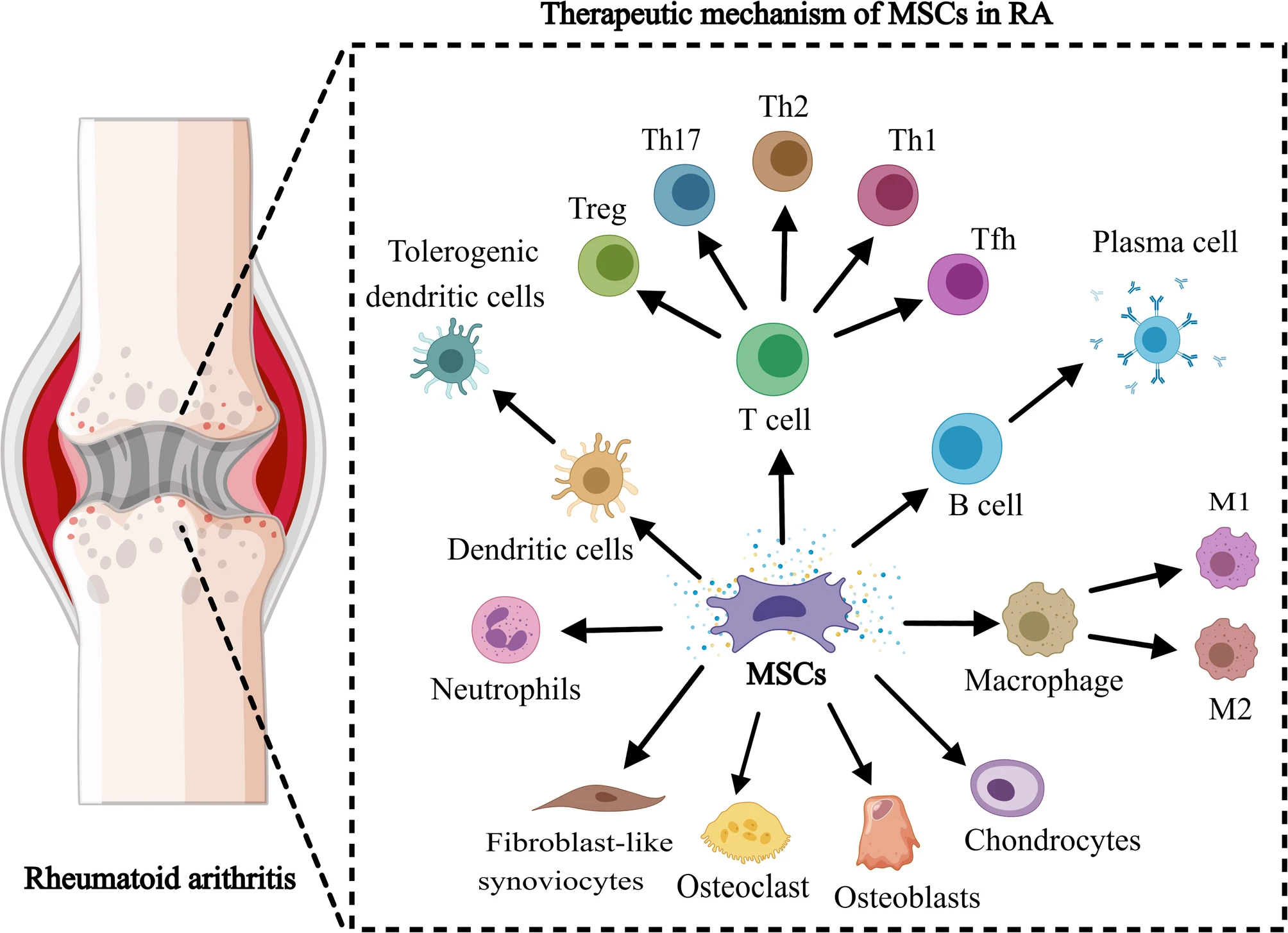 圖3:間充質(zhì)干細(xì)胞在治療類風(fēng)濕性關(guān)節(jié)炎中的機(jī)制。 圖3:間充質(zhì)干細(xì)胞在治療類風(fēng)濕性關(guān)節(jié)炎中的機(jī)制。