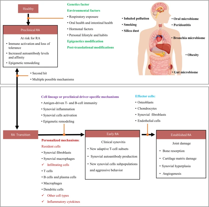 圖2:類風(fēng)濕性關(guān)節(jié)炎的發(fā)生和發(fā)展。 圖2:類風(fēng)濕性關(guān)節(jié)炎的發(fā)生和發(fā)展。