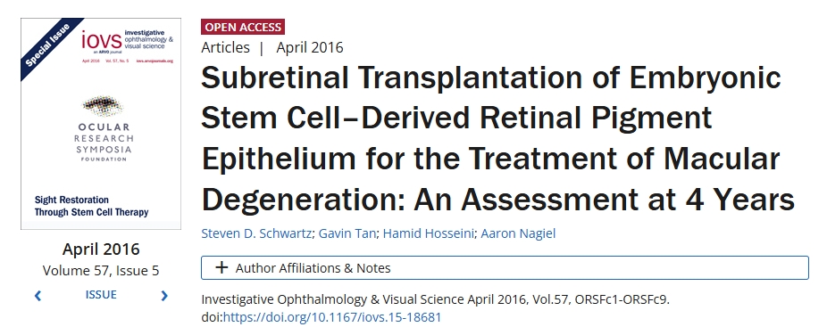 胚胎干細胞來源的視網膜色素上皮視網膜下移植治療黃斑變性:4年評估 胚胎干細胞來源的視網膜色素上皮視網膜下移植治療黃斑變性:4年評估