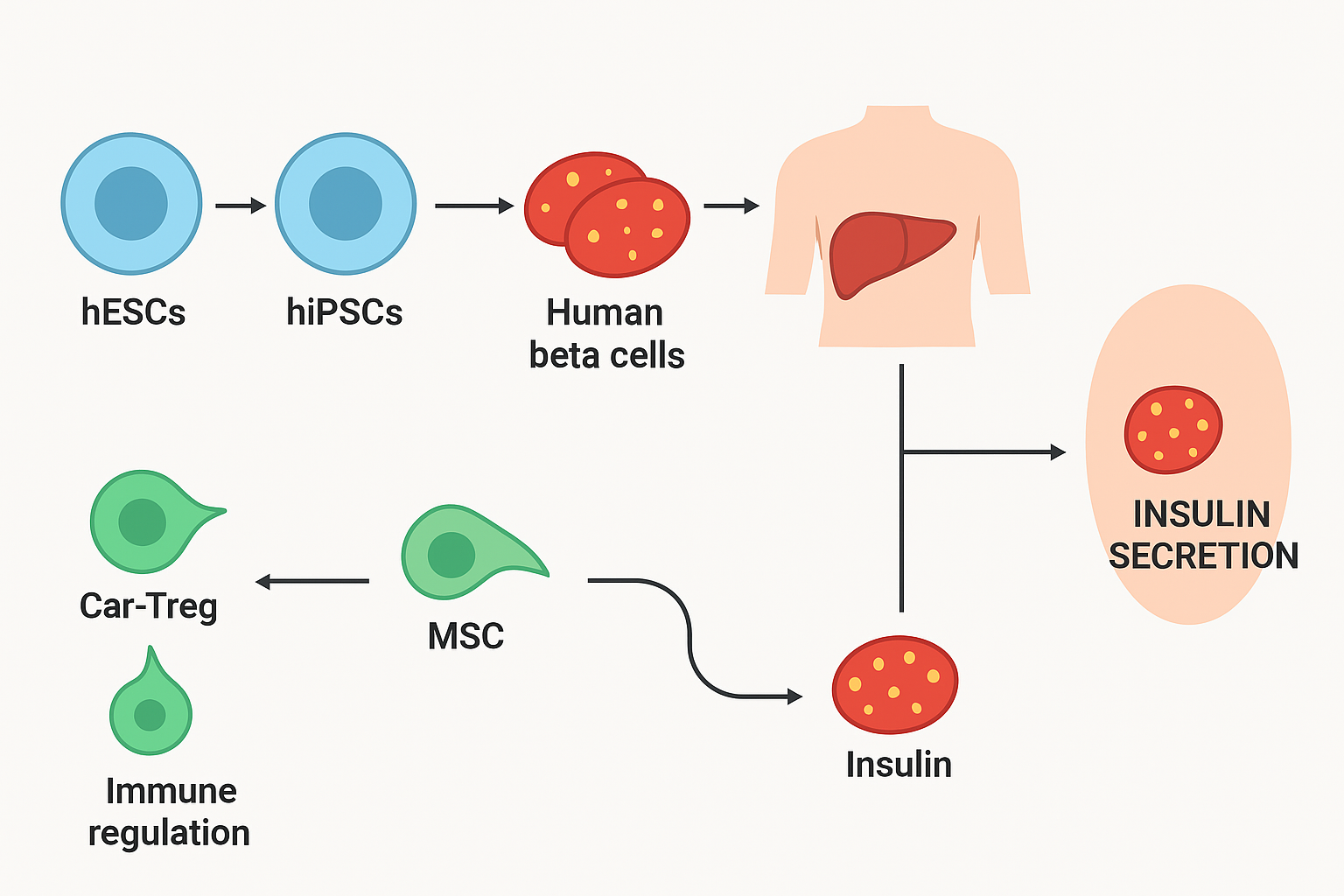 新研究有望終結胰島素注射！《糖尿病研究雜志》：干細胞療法可功能性治愈1型糖尿病