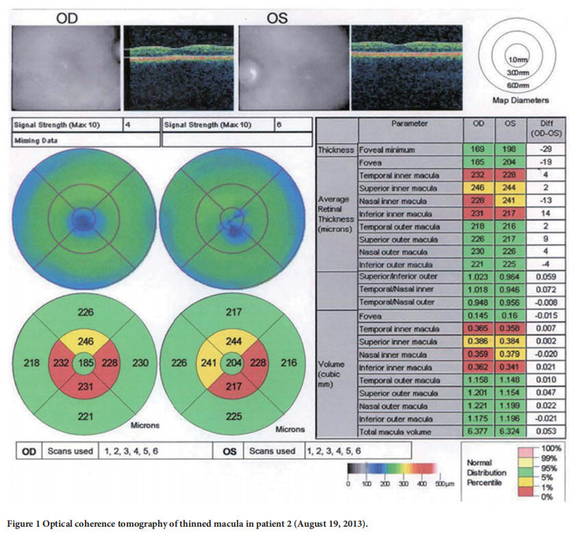 遺傳性視神經病變臨床試驗 遺傳性視神經病變臨床試驗