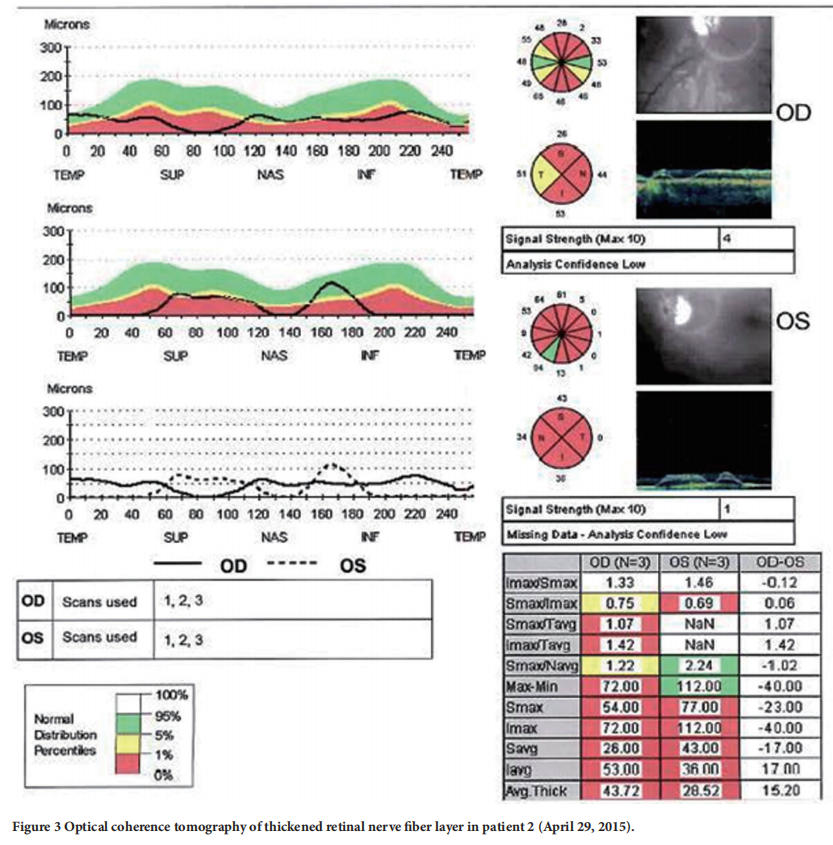 遺傳性視神經病變臨床試驗 遺傳性視神經病變臨床試驗