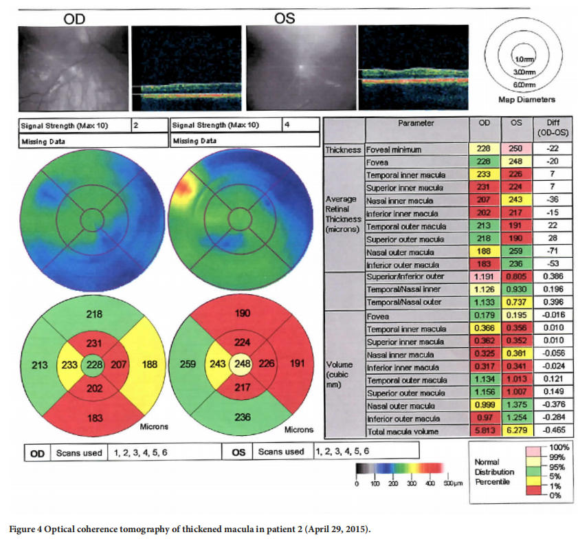 遺傳性視神經病變臨床試驗 遺傳性視神經病變臨床試驗