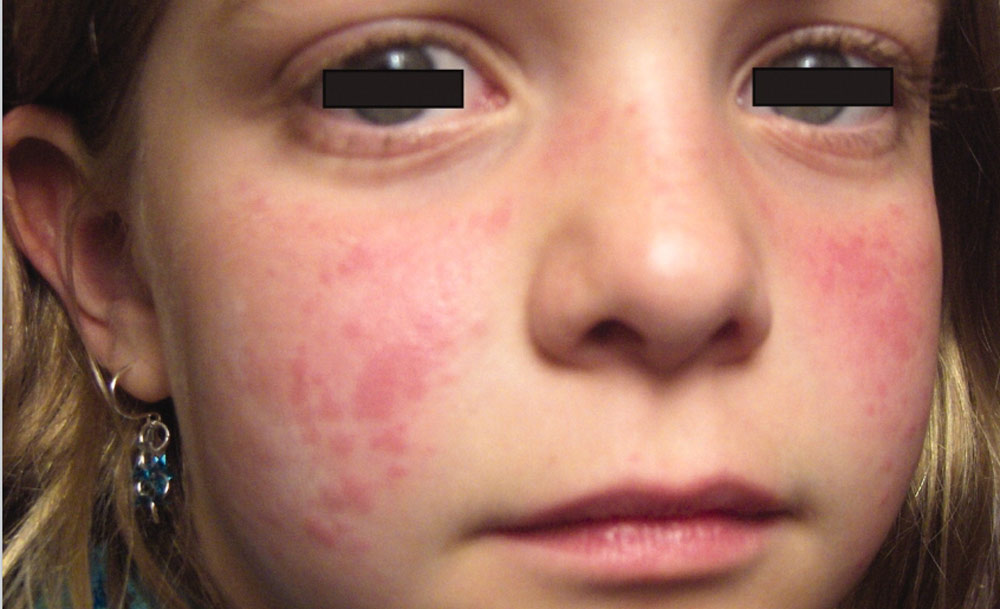 干細胞移植 干細胞移植