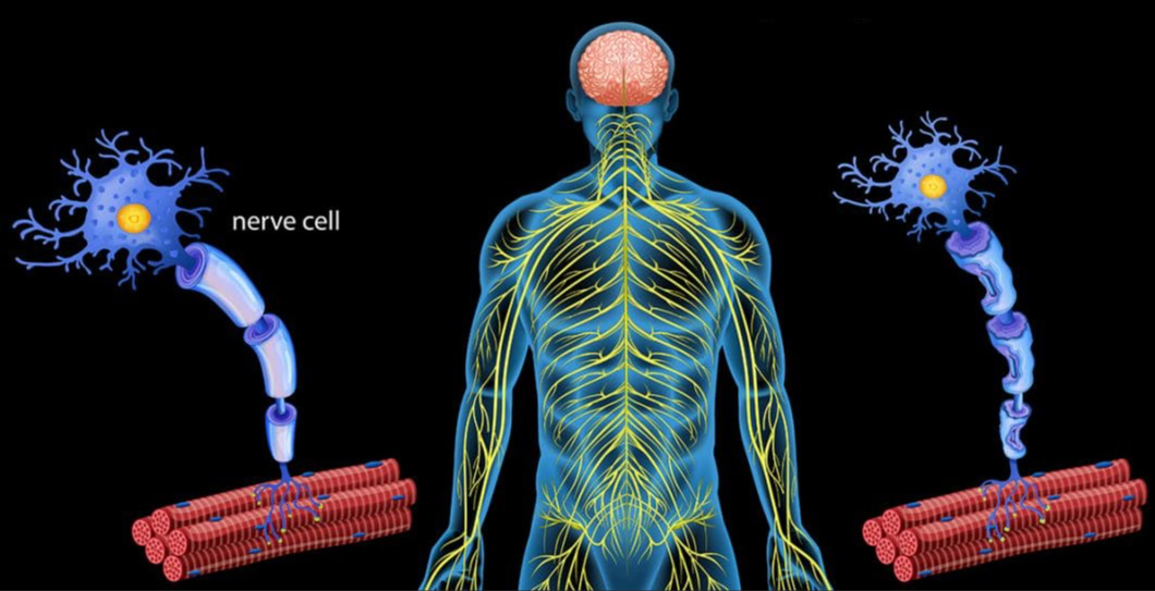多發性硬化癥 多發性硬化癥