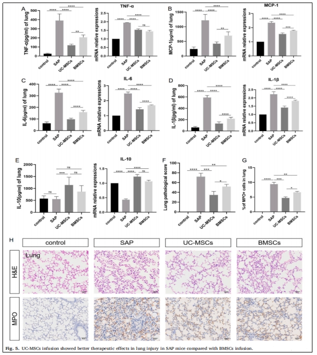 圖5:UC-MSCs輸注對SAP小鼠肺損傷的治療效果優(yōu)于BMSCs輸注。 圖5:UC-MSCs輸注對SAP小鼠肺損傷的治療效果優(yōu)于BMSCs輸注。