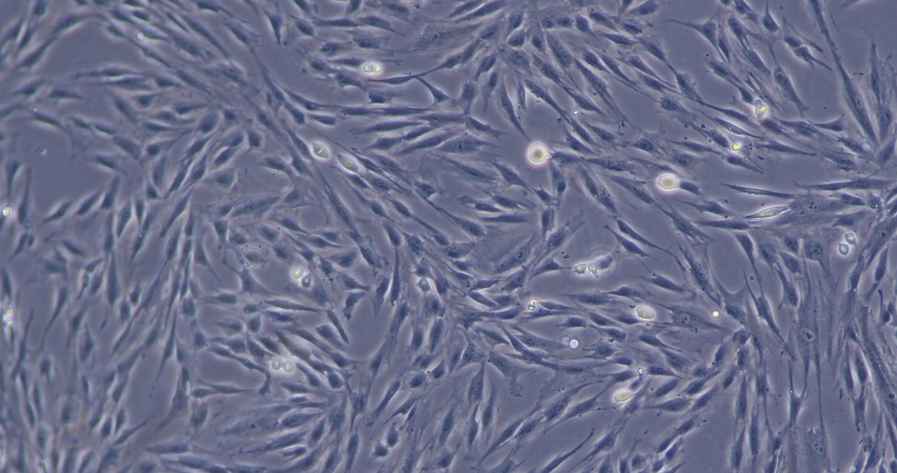 間充質(zhì)干細(xì)胞 間充質(zhì)干細(xì)胞