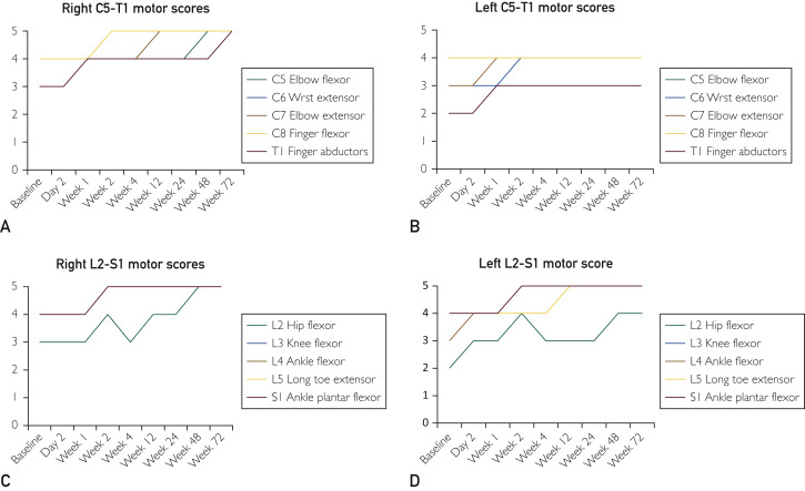 圖3:受試者各時間點脊髓損傷神經學分類國際標準運動評分。A,右上肢運動評分。B,左上肢運動評分。C,右下肢運動評分。D,左下肢運動評分。 圖3:受試者各時間點脊髓損傷神經學分類國際標準運動評分。A,右上肢運動評分。B,左上肢運動評分。C,右下肢運動評分。D,左下肢運動評分。