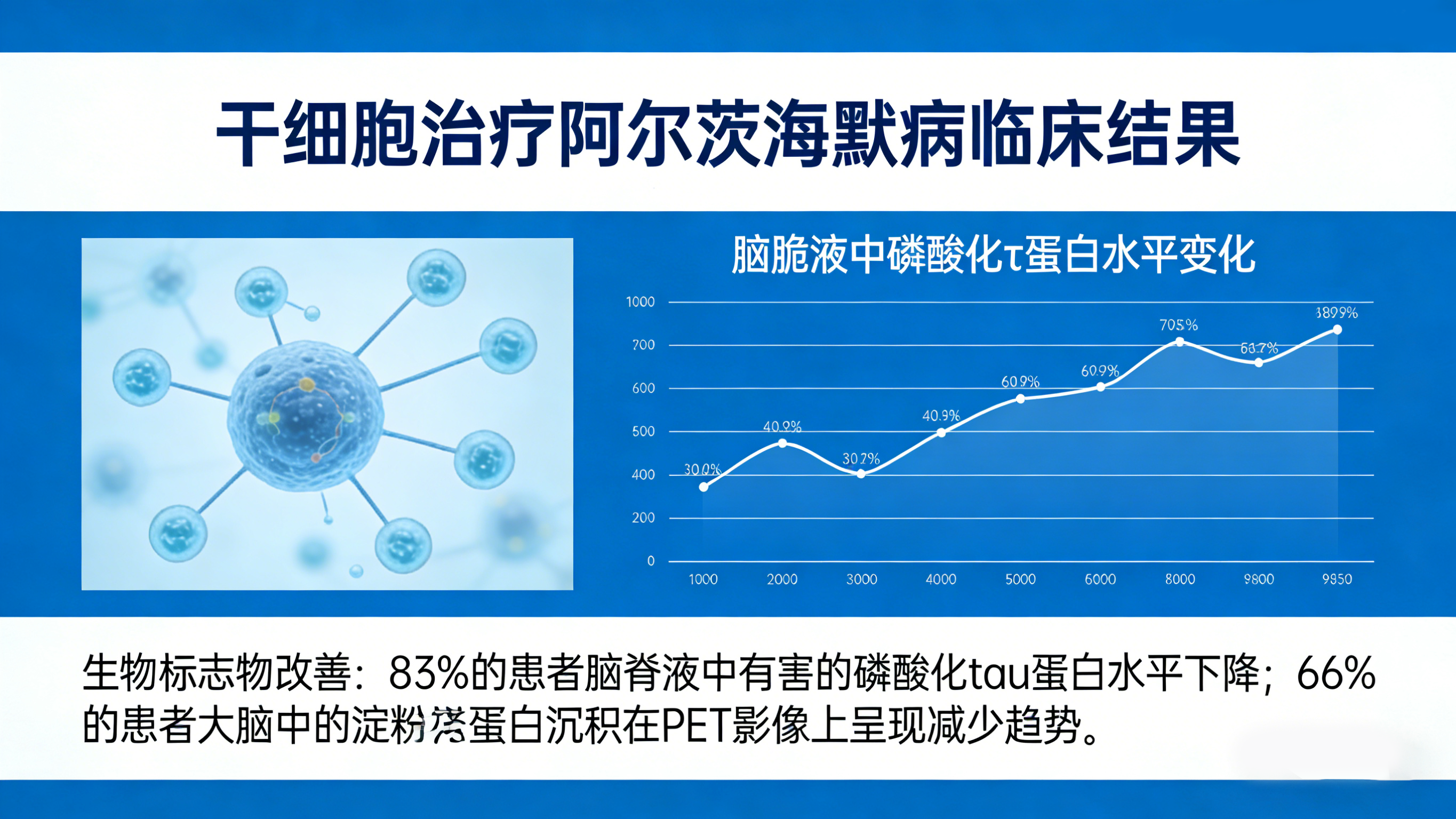 干細(xì)胞治療阿爾茨海默病臨床結(jié)果 干細(xì)胞治療阿爾茨海默病臨床結(jié)果