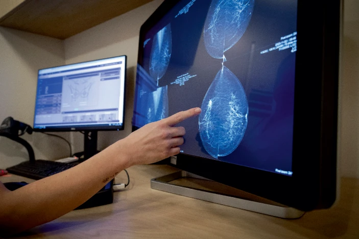 轉移性乳腺癌患者迫切需要新的治療方法。