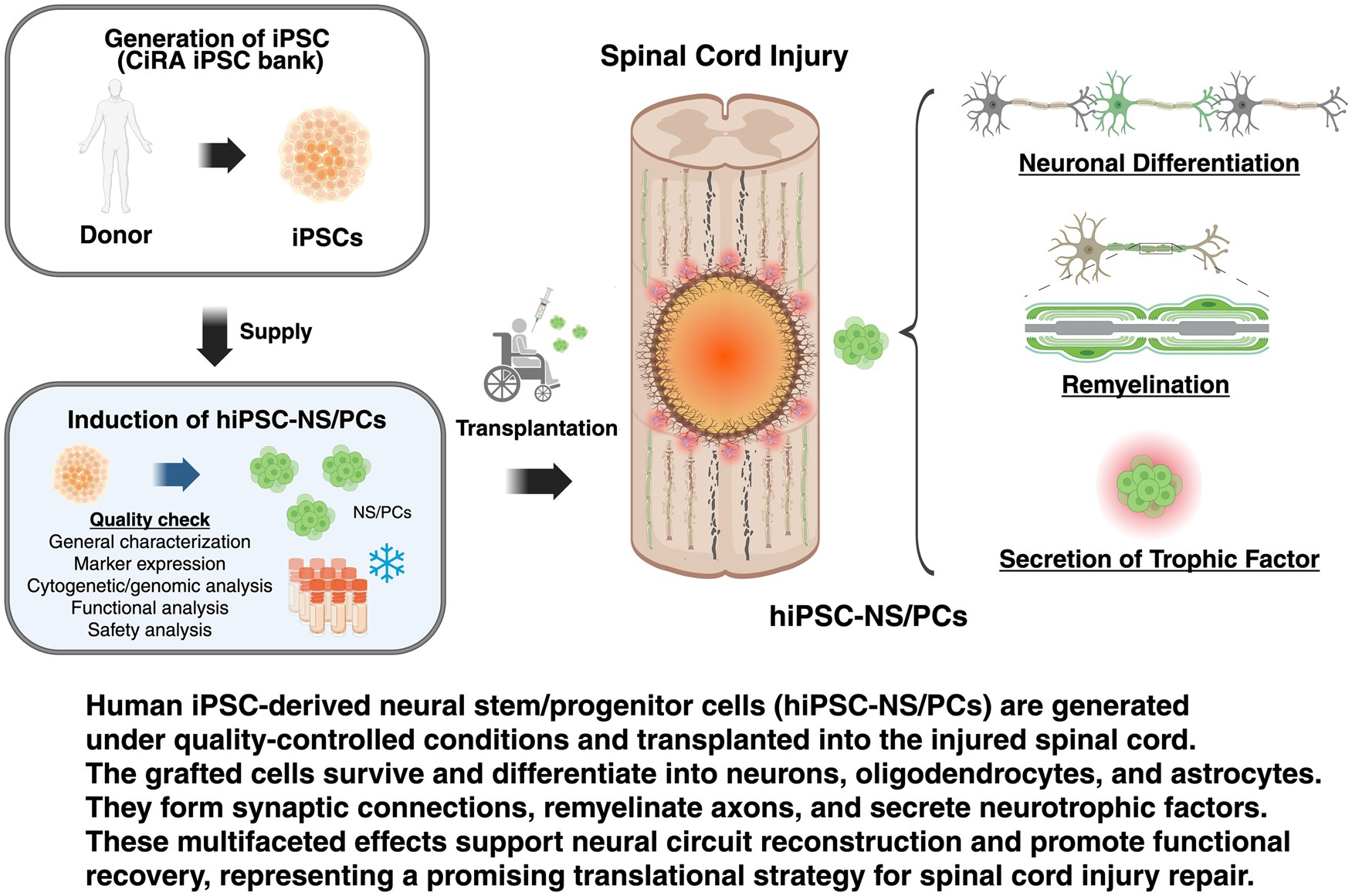 最新綜述！多能干細胞來源的神經干/祖細胞療法治療脊髓損傷：臨床進展和轉化展望